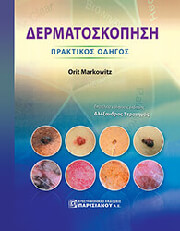 dermatoskopisi photo