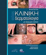 atlas kliniki dermatologia me egxromes eikones photo