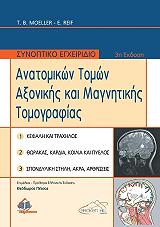synoptiko egxeiridio anatomikon tomon axonikis kai magnitikis tomografias photo synoptiko egxeiridio anatomikon tomon axonikis kai magnitikis tomografias photo