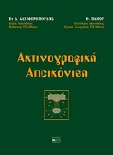 aktinografiki apeikonisi photo