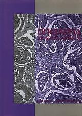 ogkologia toy peptikoy systimatos photo