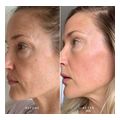 lifting serum prosopoy bee factor xabiari me yaloyroniko majestem 30ml extra photo 1