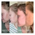 keraloifi prosopoy bee factor gia akmi spyrakia 30ml extra photo 3
